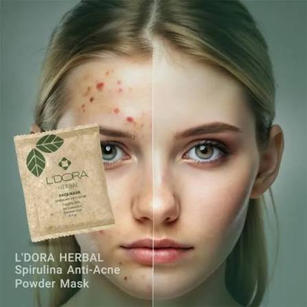 ماسک پودری اسپرولینا ضد جوش anti-acne
