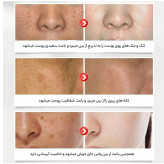 سرم برنج 15 میل آبرسان صورت - هیوا شاپ